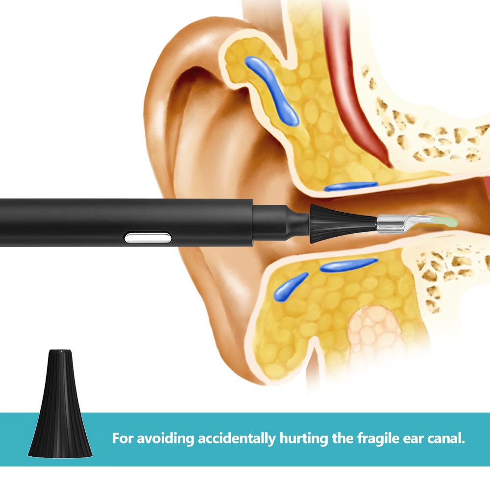 Wireless WiFi visual otoscope 3.9mm high-definition waterproof earwax removal ear canal endoscope luminous ear spoon