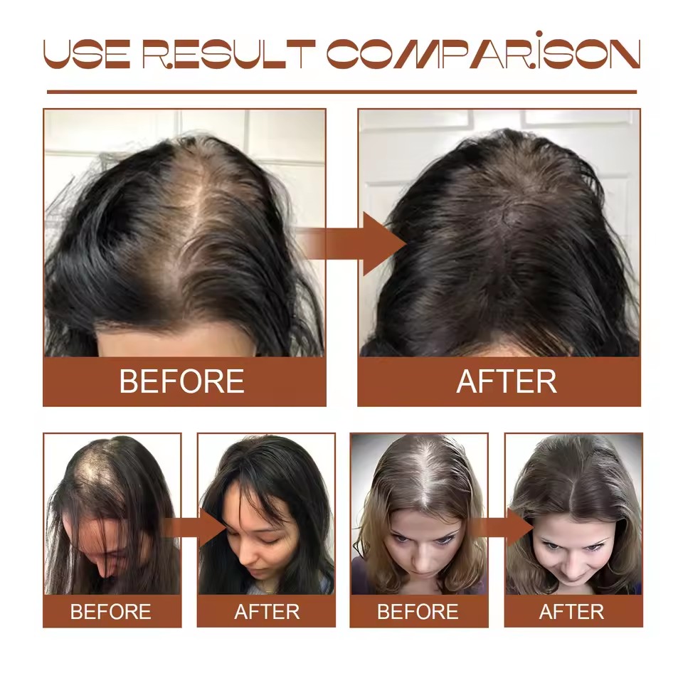 Batana oil hair conditioner that improves dry and curly hair, is soft, fluffy, thick, moisturizing, and nutritious