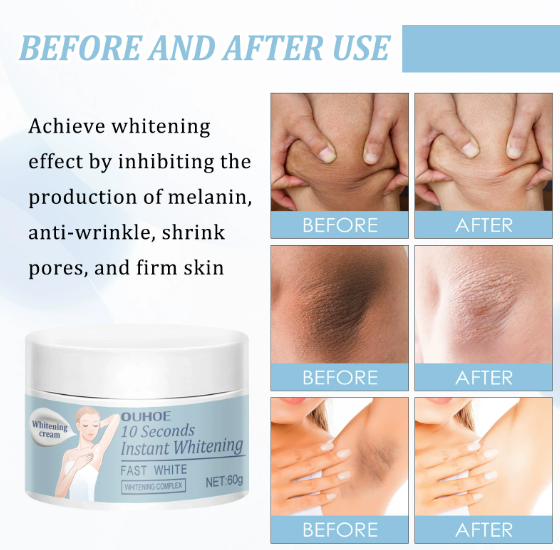 Vitamin C Skin Brightening Cream Private Parts Underarm W-hitening Butt Knee Brighten Inner Thigh Remove Melanin Cream 60g