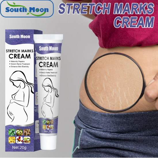 Stretch marks repair cream fat stretch marks repair cream postpartum to pregnant lines mommy cream to desalinate growth lines