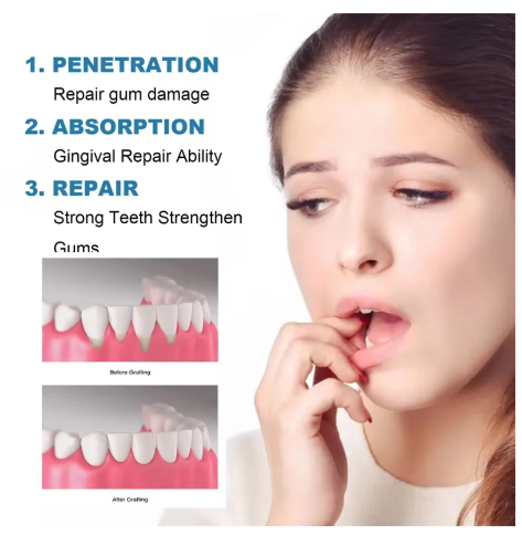 Rapid Repair Gums Serum Effectively Relieve Tooth Allergy Dental Caries Tooth Cleaning Toothpaste Relieve Tooth Damage Drops