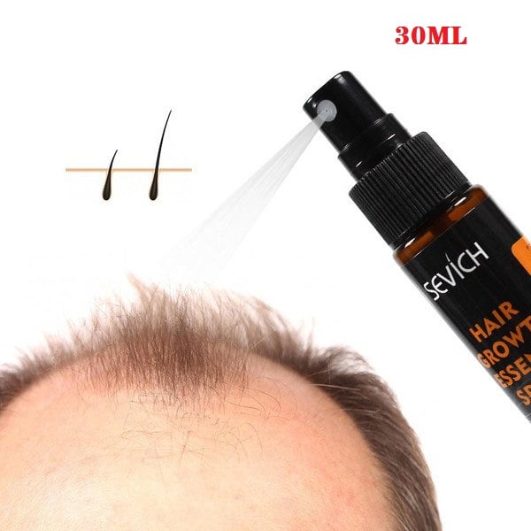 30Ml Haargroei Vloeibare Spray Helpen Voor Haargroei Haaruitval Behandeling Beschadigd Haar Reparatie Groeiende Haargroei