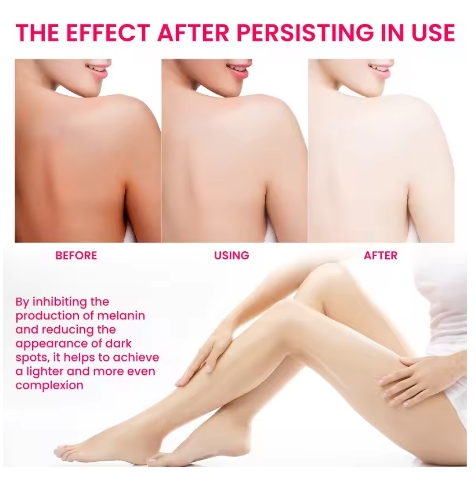 Inner Thigh Brightening Cream Private Parts Lighten Cream Intimate Area Armpit Knee Bleach Emulsion Underarm Brighten Skin Care