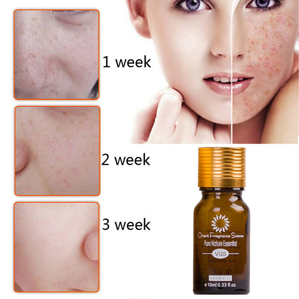 ultra brightening spotless oil skin care dark spots remove ance brun strentch marks scar removal brightening skin essence 30ml