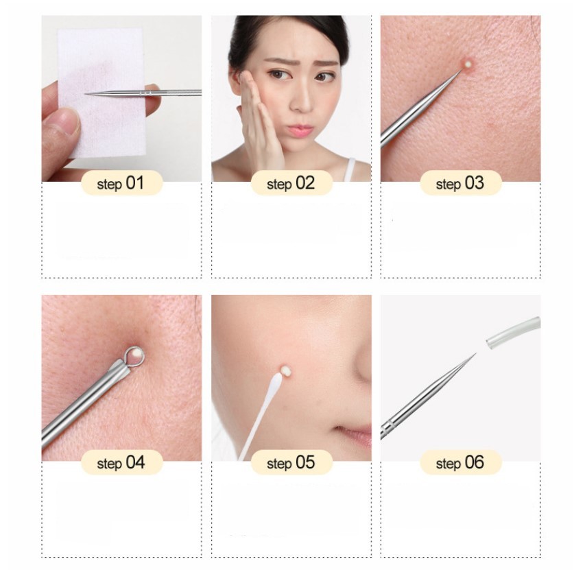4pcs/set Stainless Steel Blackhead Comedone Acne Corrector Remover Extractor Skin Care Pore Cleaner Needles Remove Tools
