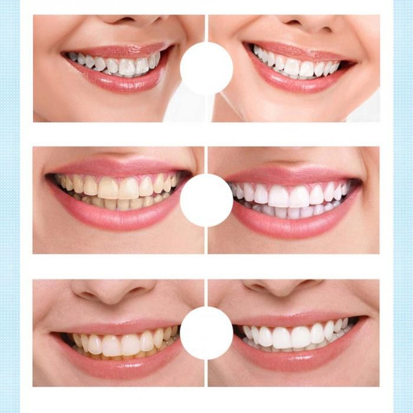 Teeth Whitening Gel Pen Oral Care Remove Stains Tooth Cleaning Tool Whitener Teeth Whitening Oral Hygiene Pen