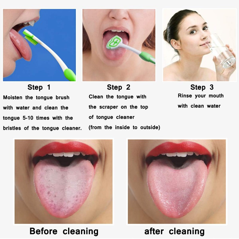 1Pc Silicone Tongue Scraper For Oral Hygiene,Tongue Cleaning Tool Tongue Brush Food Debris Clea