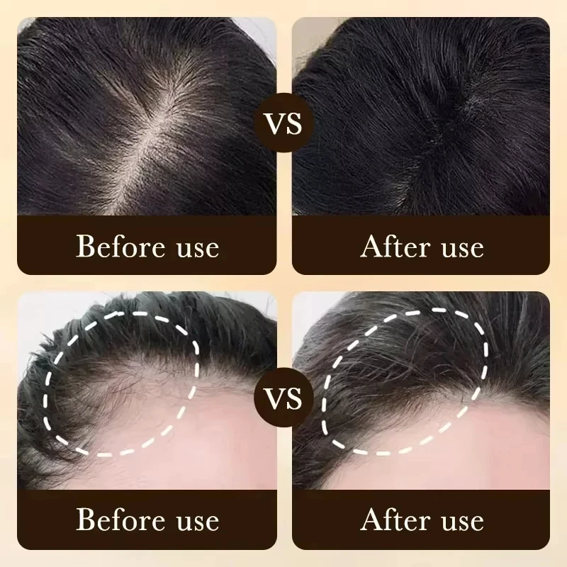 2*30MLHair Growth Essential Loss Regrowth Treatment Strengthens Hair Nourishes Scalp Light Weight Non Greasy Improve Circulation