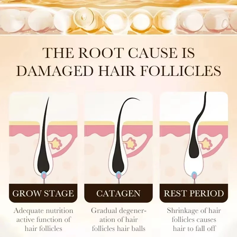 2*30MLHair Growth Essential Loss Regrowth Treatment Strengthens Hair Nourishes Scalp Light Weight Non Greasy Improve Circulation