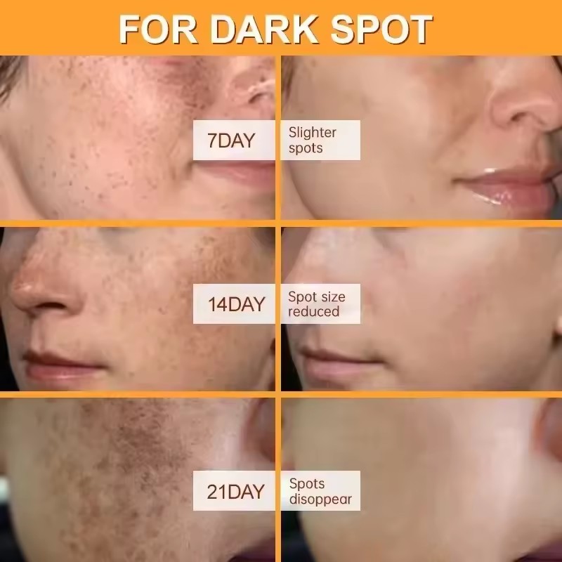 Miao Dufang Herbal Cream Miaoqun Dufang External Use Zhiyang Ointment Mosquito Bite Skin Allergy