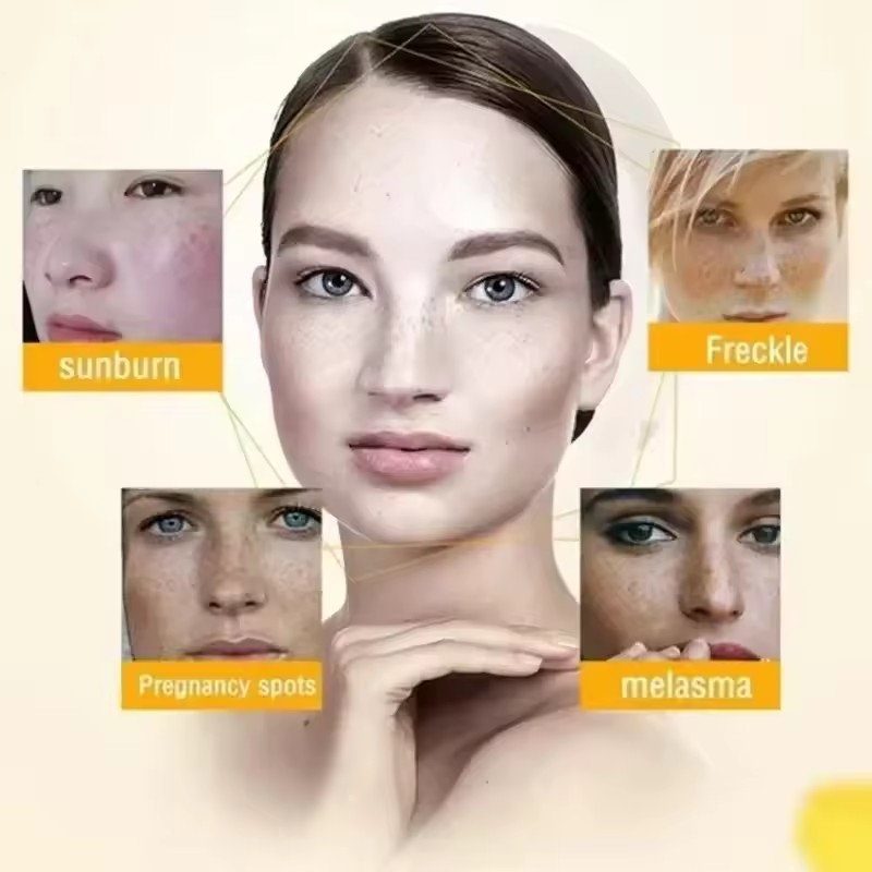 Miao Dufang Herbal Cream Miaoqun Dufang External Use Zhiyang Ointment Mosquito Bite Skin Allergy