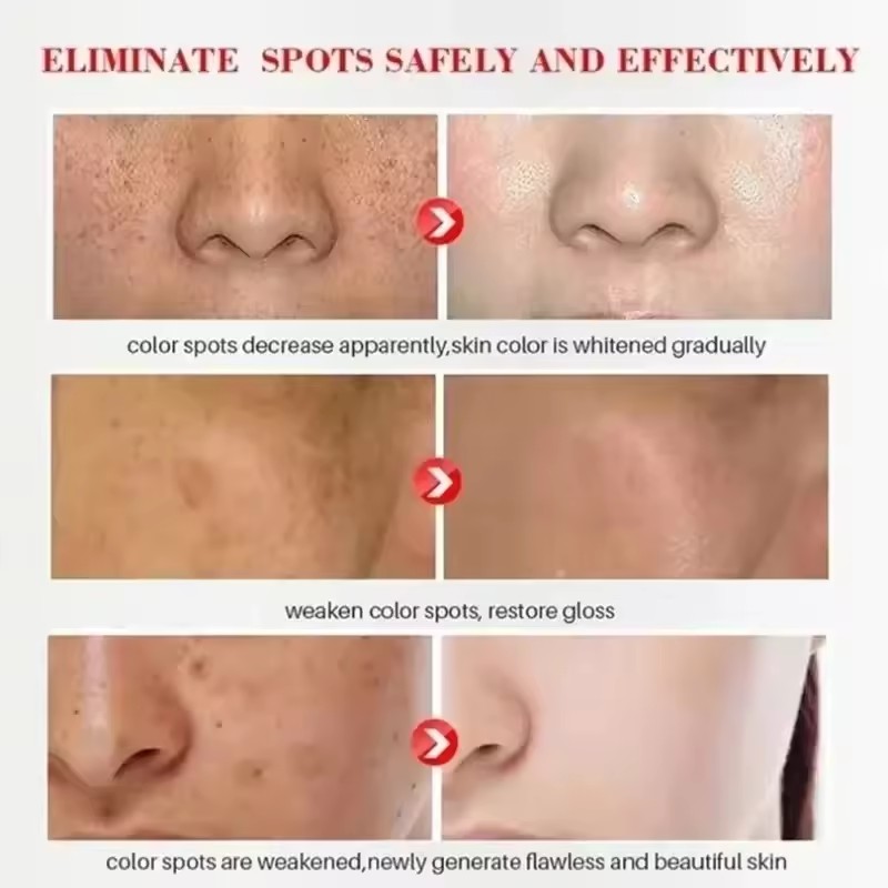 Miao Dufang Herbal Cream Miaoqun Dufang External Use Zhiyang Ointment Mosquito Bite Skin Allergy