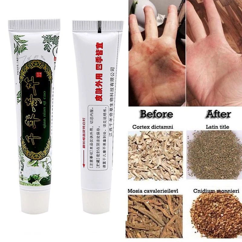 Transocean Millennium Qicao Zhiyang Ointment Authentic Antibacterial Cream Skin Ointment