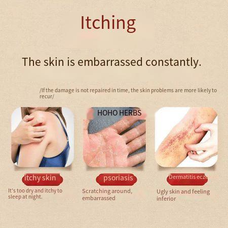 2026 new Pikangwang old brand herbal bacteriostatic cream for men and women with pruritus and dermatitis of vulva for external