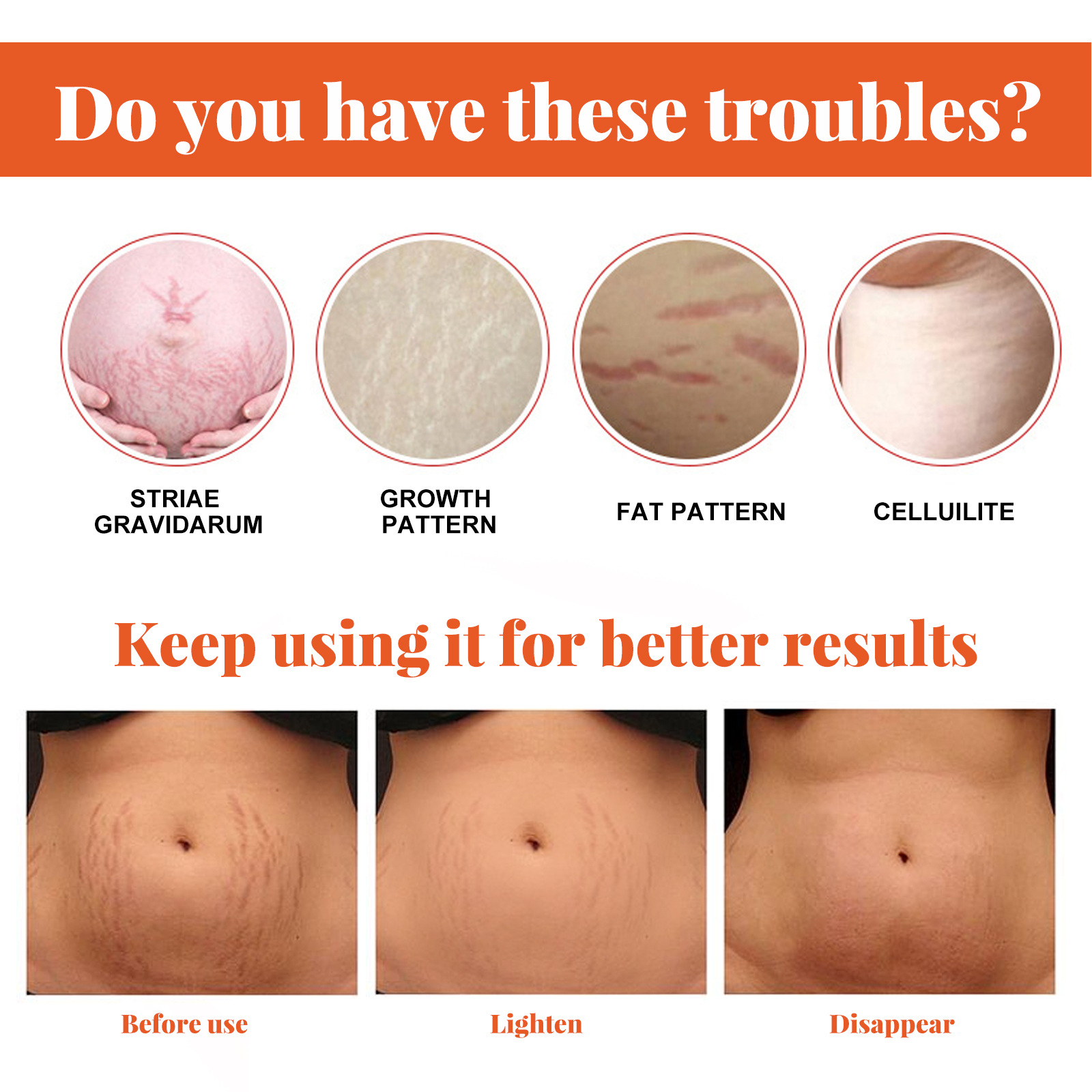 Stretch Mark Repairing Essential Oil Deep Nourishing Enhance Skin Elasticity Fade Marks AntiWrinkle Body Oil For Pregnant Women