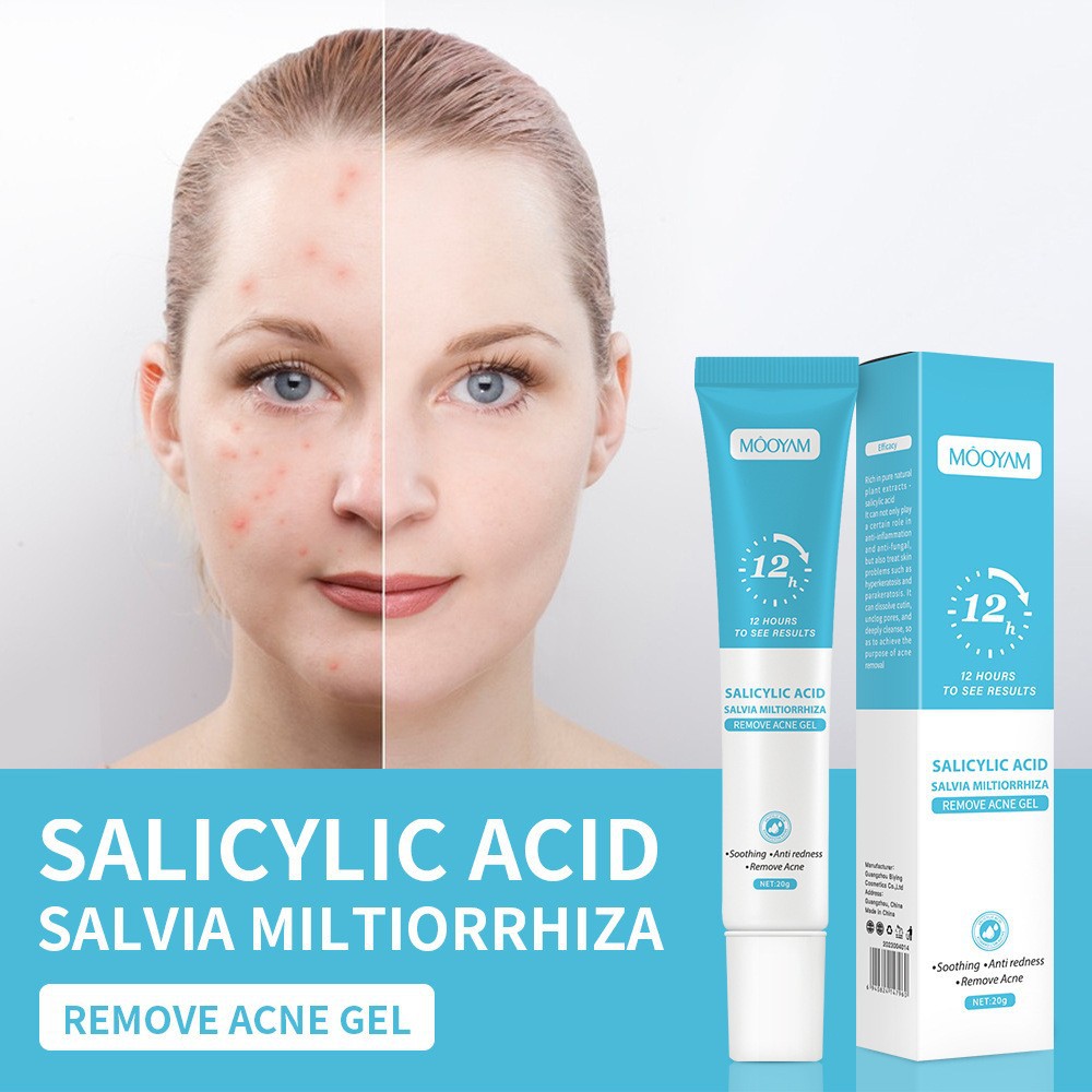Acne Cream For Face Pimples Remover Treatment Shrink Pores Oil Control Lighten Acne Marks Whitening Smoothing Facial Skin Care