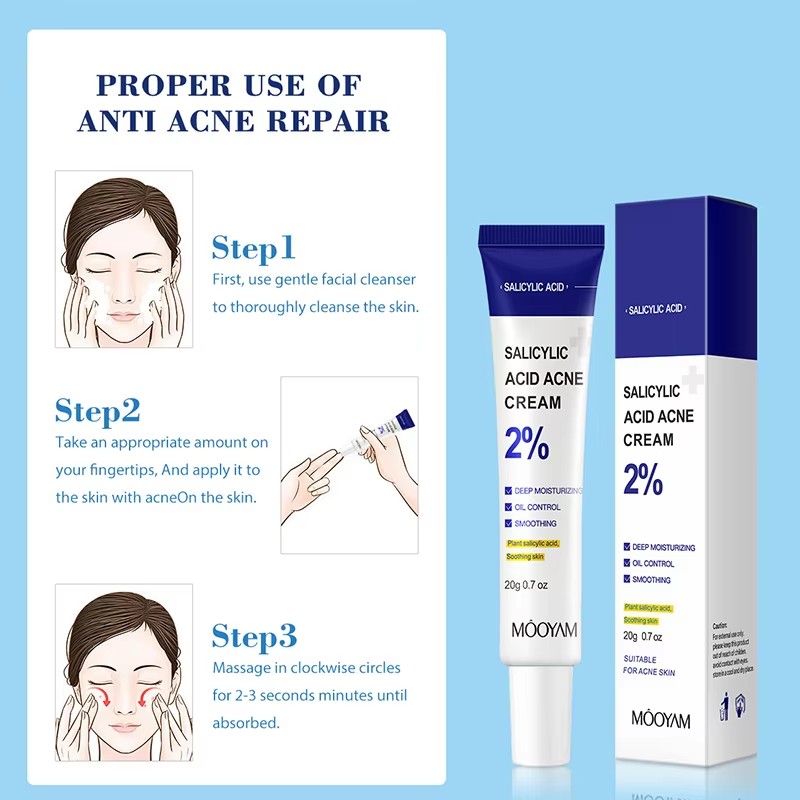 Salicylic Acid Acne Removing Cream Acne Removing Cream Soothes Lightens Acne Marks Gently Repairs Skin Care Moisturizes Cream
