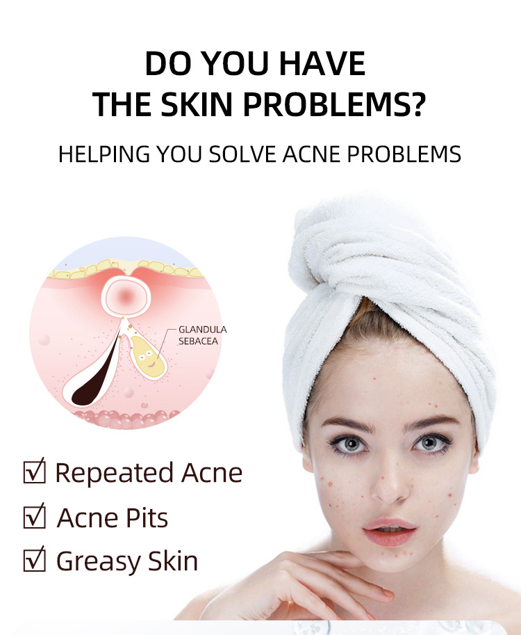 Acne Cream For Face Pimples Remover Treatment Shrink Pores Oil Control Lighten Acne Marks Whitening Smoothing Facial Skin Care