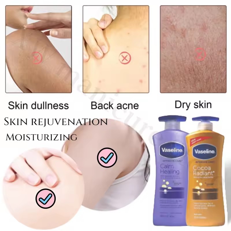 Vaseline Intensive Care Body Lotion 600ml Deep Nourishing Repairing Moisturizing Improve Dullness Whitening Cream Skin Care