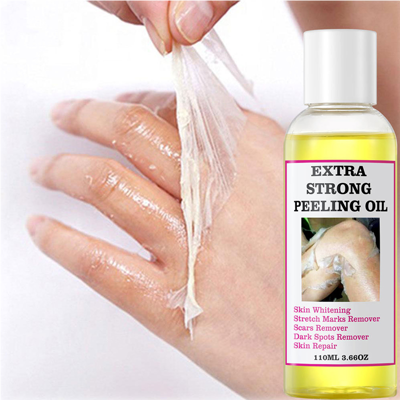 Yellow Peeling Oil Peeling Oil Exfoliating Oil Elbow Knee Fingers Black Yellow Peeling Oil Brightening Body Lotion