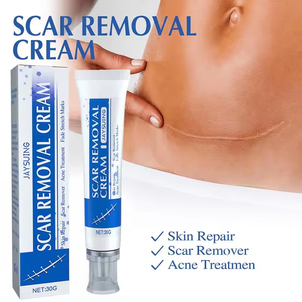 Centella Asiatica Scar Removal Cream Rapid Repair of New Old Scars,Spots,Burns All Natural Treatment with Shea Butter