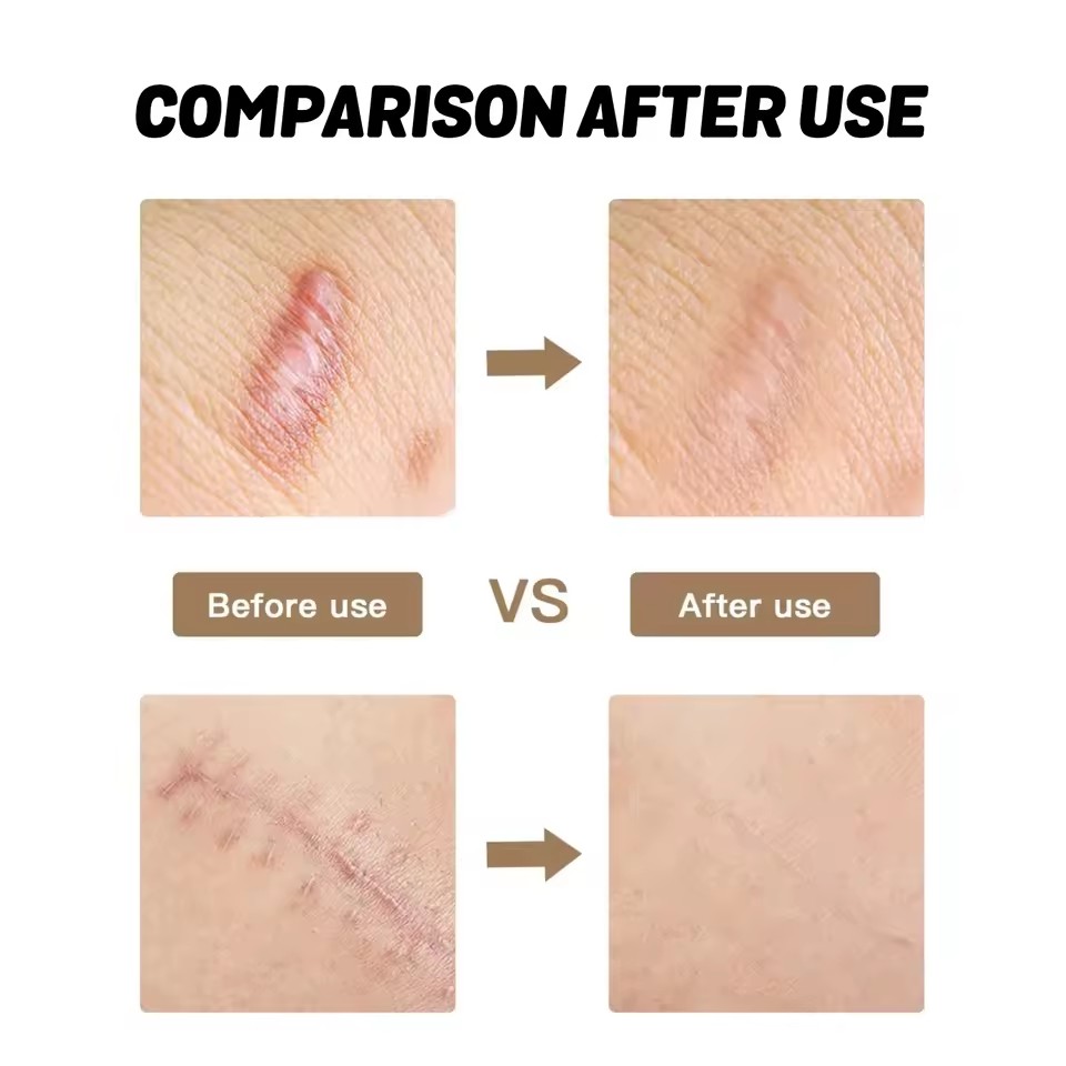 Gel Moisturizing and repairing smoothing body skin fading care gel