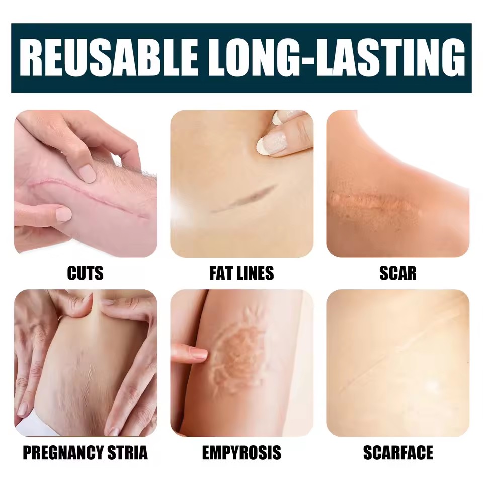 1PCS Centella Asiatica Scar Removal Cream Rapid Repair of New Old Scars,Spots,Burns All Natural Treatment with Shea Butter