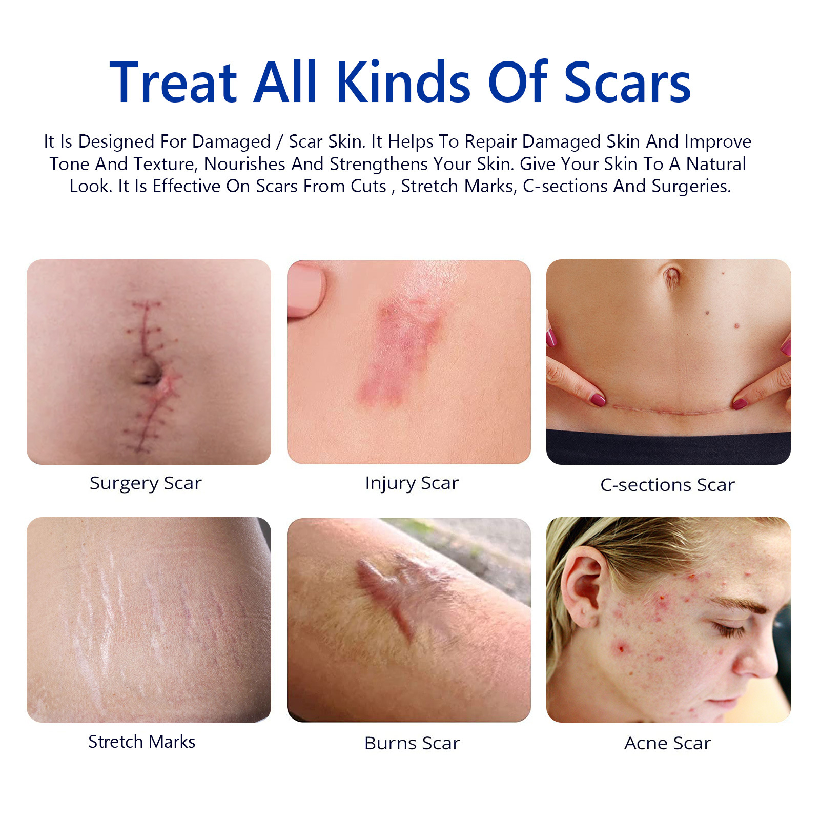 1PCS Centella Asiatica Scar Removal Cream Rapid Repair of New Old Scars,Spots,Burns All Natural Treatment with Shea Butter