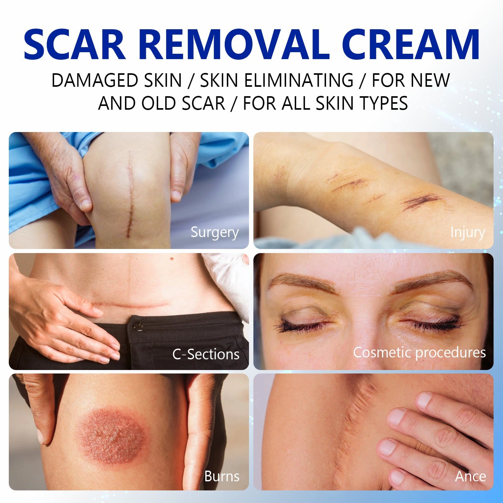 Skin Care Cream Scars Repair Gel Face Body Lotion Smoothing Hydrating Stretch Marks Cream Post Surgery Scar Care Gel Moisturize