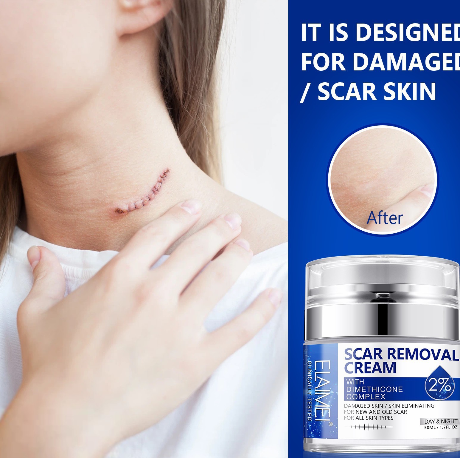 ELAIMEI's new pressed scar cream scar desalination cream 50ML