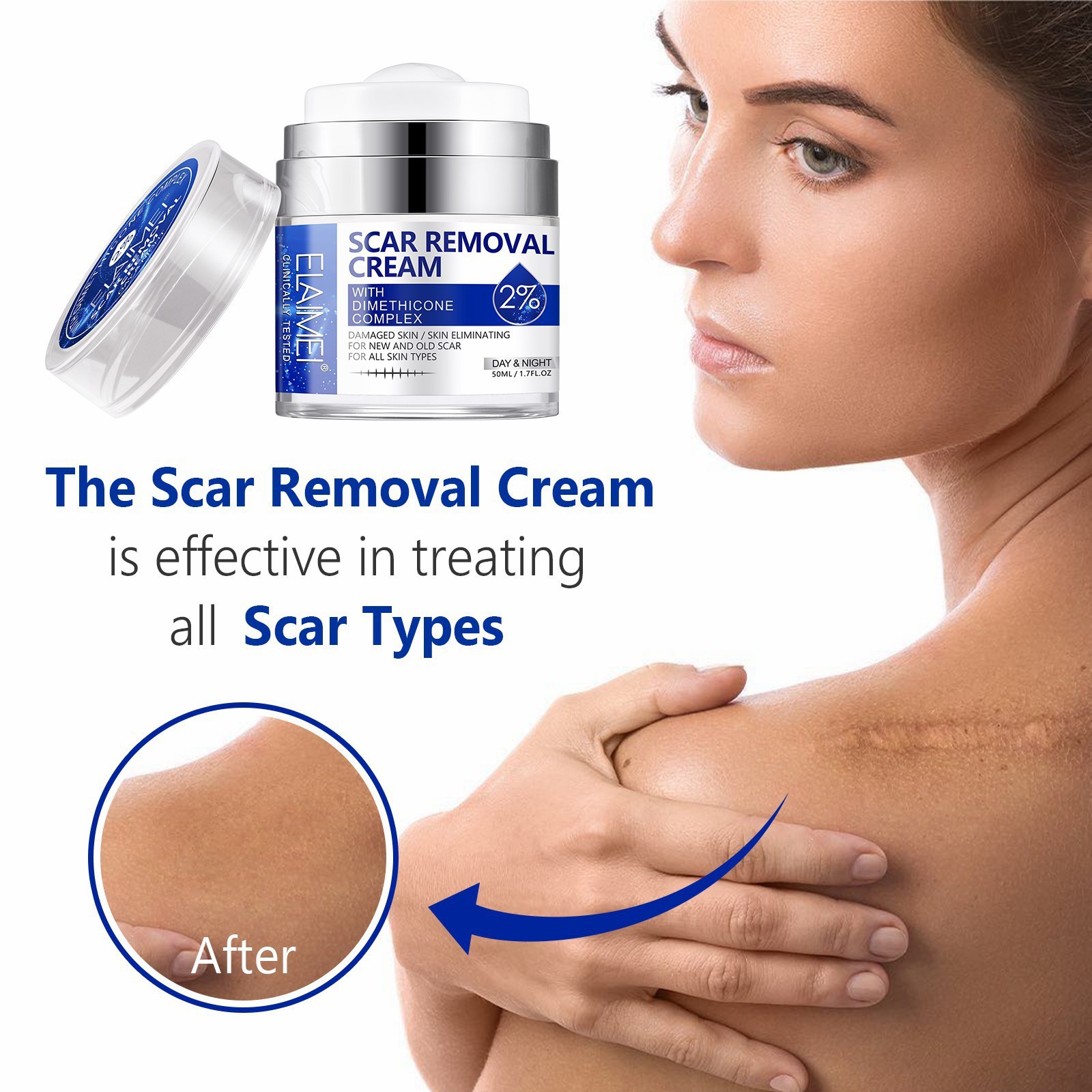 ELAIMEI's new pressed scar cream scar desalination cream 50ML