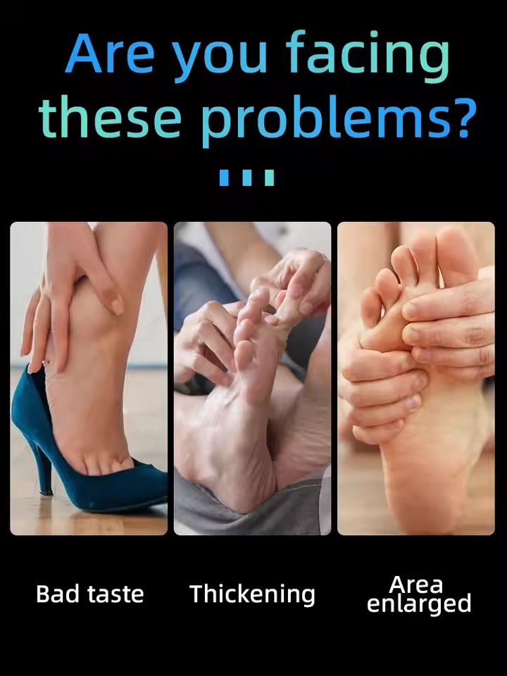 2026 new nails become translucent and fungal free