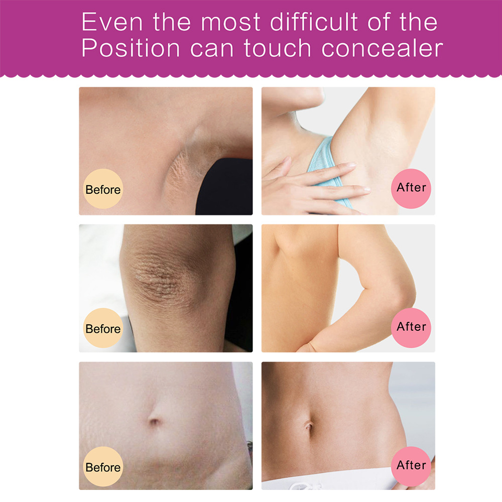60ml Underarm Whitening Cream Dark Skin Improve Melanin Pigmentation Bleaching Brighten For Underarms Knees Elbows Care